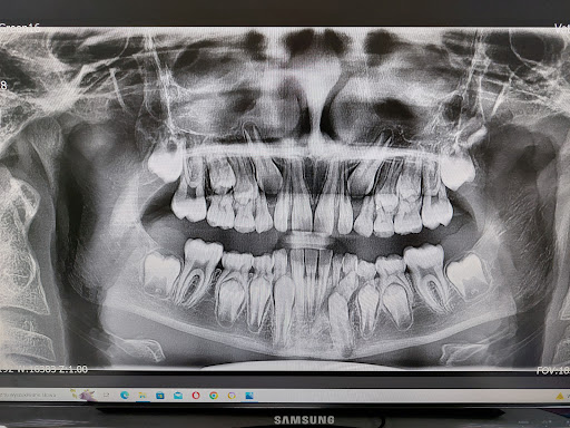 STOMATOLOGIA MIKROSKOPOWA dr Katarzyna Sondej-Czachura