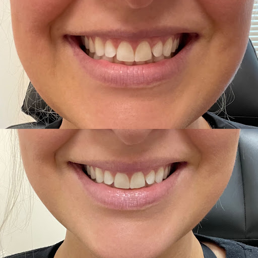 Laser Lipo & Vein Center