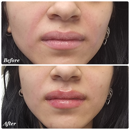 Royal MedSpa - Thumbnail