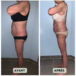 Photo n°10 de Atlantica Minceur : Madérothérapie｜Drainage Lymphatique｜Nutrition à Marseille (Centre d'amincissement)