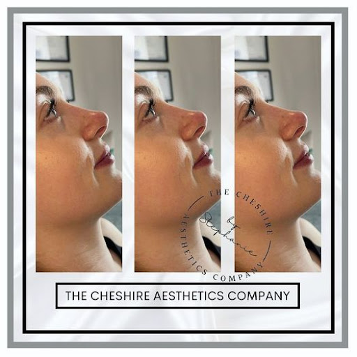 The Cheshire Aesthetics Company - Thumbnail
