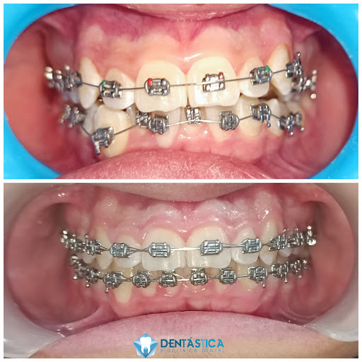Dentástica.Cln - Thumbnail