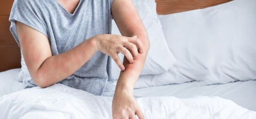 Best Skin Allergy Specialists in Jaipur Skin allergies can cause…