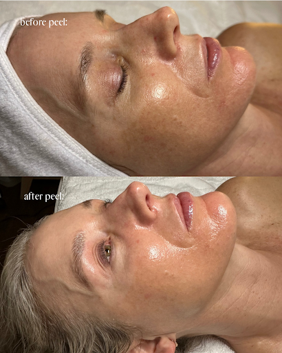Tru Skin Esthetics - Thumbnail