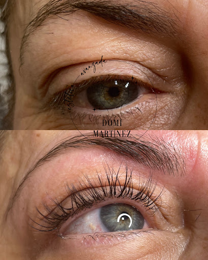 Estética Avanzada Domi Martínez Gallery - Spain