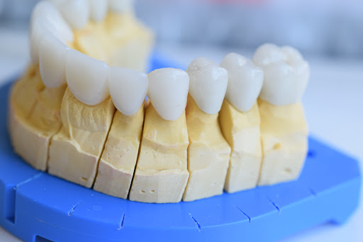 Clínica Dental Diente Sano - Thumbnail