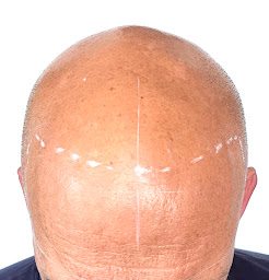 Photo n°12 de Gaëlle Passion Dermo à Châteauroux (Clinique de maquillage permanent)