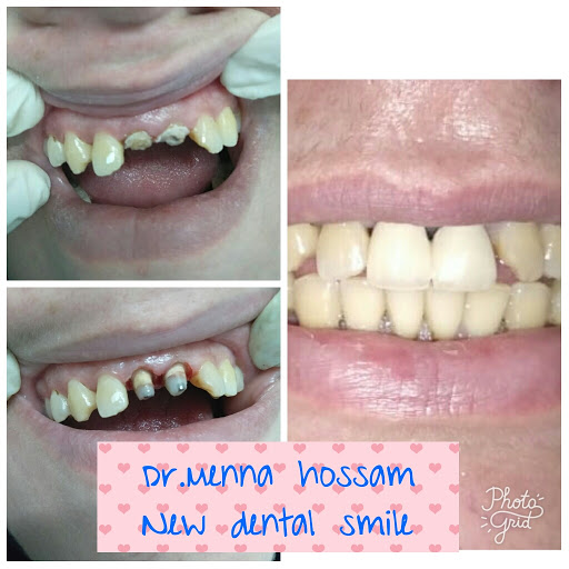 مركز شايني وايت لزراعة وتجميل الأسنان - صورة 5