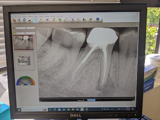 Endospecialists- Root Canal Specialist