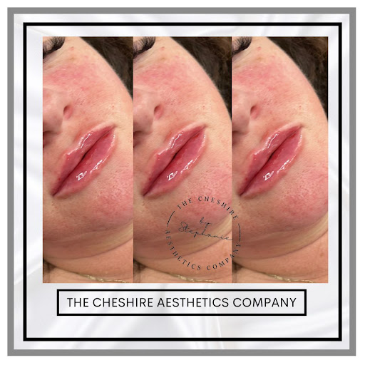 The Cheshire Aesthetics Company - Thumbnail