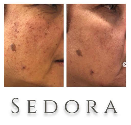 Sedora Laser and Skin Spa