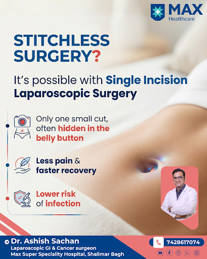 🔍 “Wait… where are the stitches?” With Single Incision Laparoscopic Surgery (SILS), advanced mini… post image