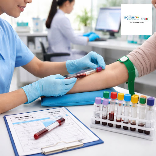 Thyroid hormones control energy, mood, and weight. At Agilus Diagnostics - Sector 9, Sanpada, Nav… post image