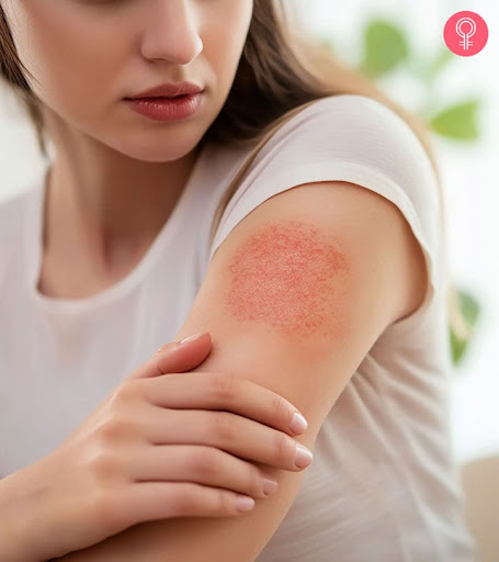 Red, itchy skin can be a sign of eczema, dermatitis, allergi