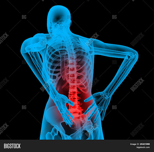 RADIOGRAFIA DIGITAL TAPILULA - Thumbnail