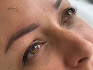 Photo n°13 de DERMODESIGN MERIGNIES à Mérignies (Service de détatouage)