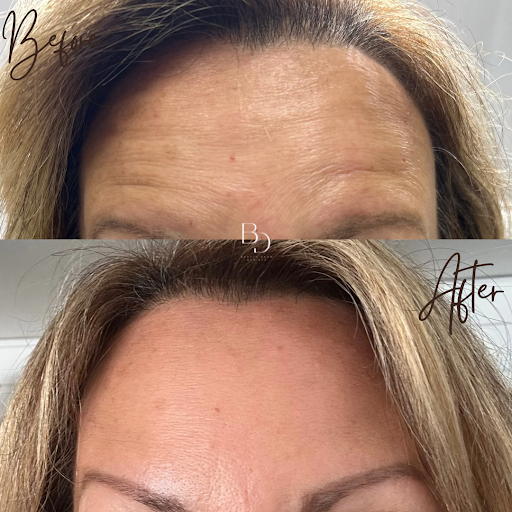 Beauty Derm Med Spa