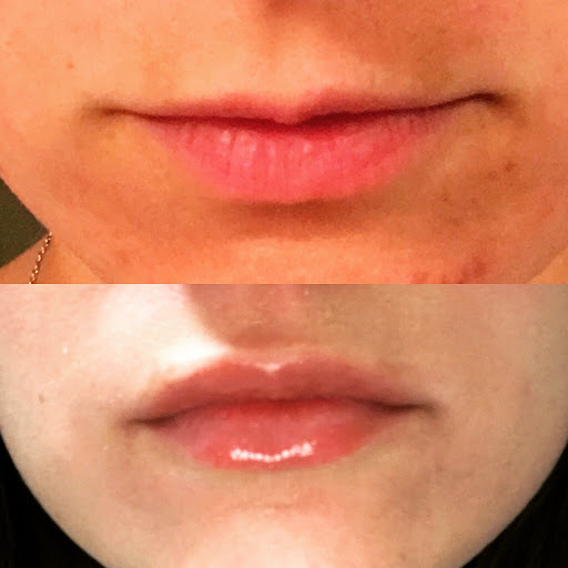 Auburn MedAesthetics