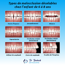 Photo n°6 de Dr Daniel BOUHNIK - Orthodontiste Saint Ouen à Saint-Ouen-sur-Seine (Orthodontiste)