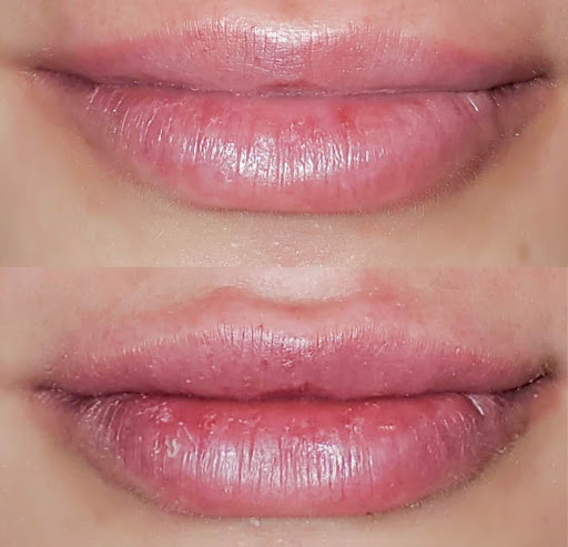 Elase Medical Spa - Sugarhouse