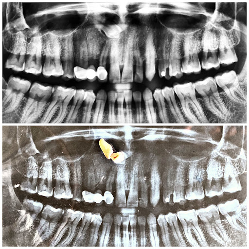 Cirujano dentista Jafet Jiménez (dentaliving) - Thumbnail