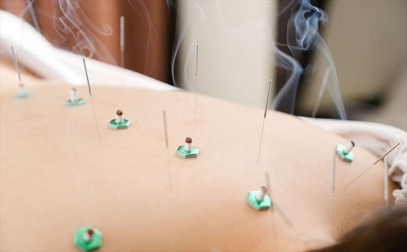 こいわ鍼灸院HARICORE