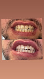 Photo n°14 de KS Bien-Etre à Agen (Service de blanchiment des dents)