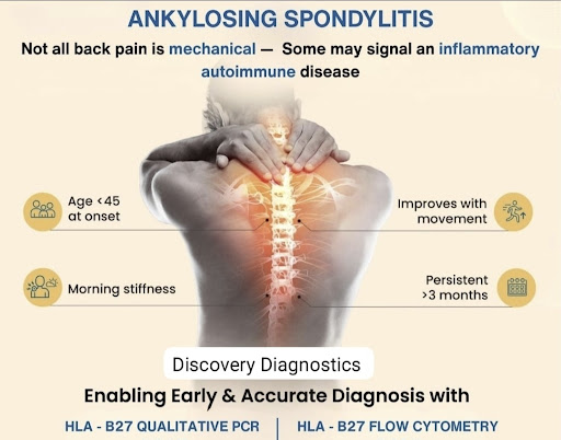 Discovery Diagnostics present very economical HLA-B27 by pcr  tst for Sponydilitis post image