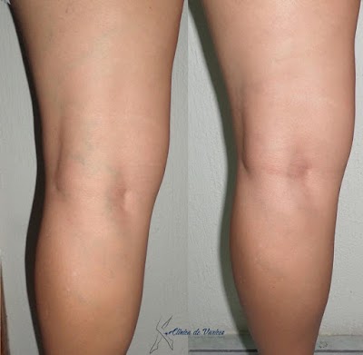 Photos of Cl&iacute;nica de Varices