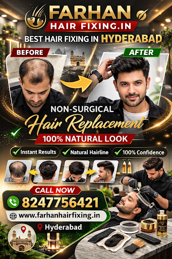 Get a confident new look with non-surgical hair replacement in Hyderabad at Farhan Hair Fixing. post image