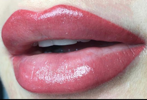 Dermaskin - Thumbnail