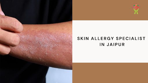 Find relief from skin allergies with the help of our expert…