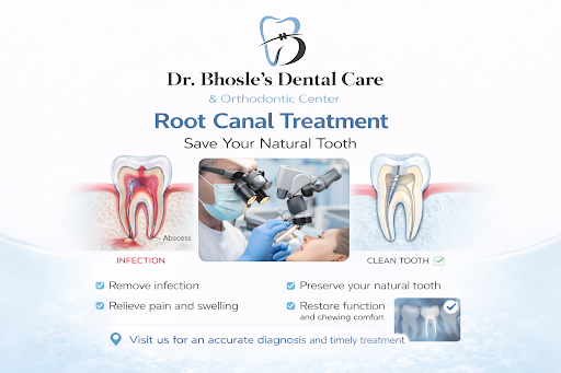 #RootCanalTreatment #DentalCare #SaveYourTooth #ToothPainRelief #HealthySmile #DentistNearYou #Sm… post image