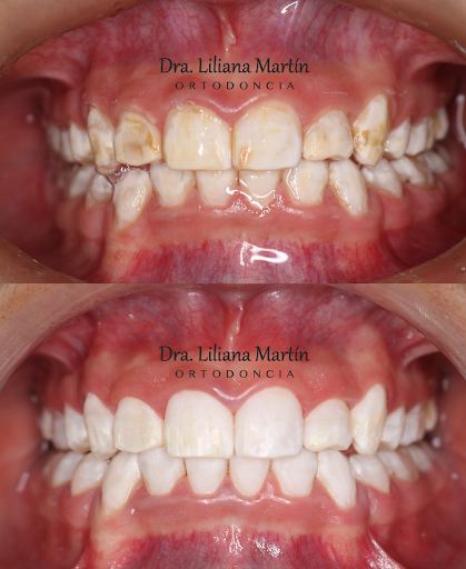 Dra Liliana Martín - Ortodoncia y Odontología general - Thumbnail