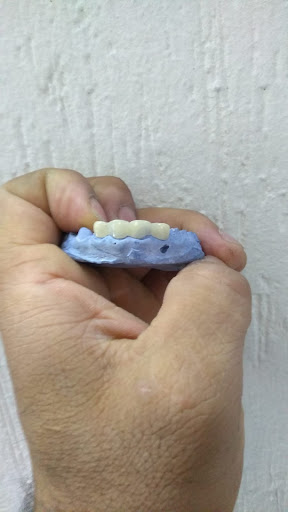 Dental Nissi - Thumbnail