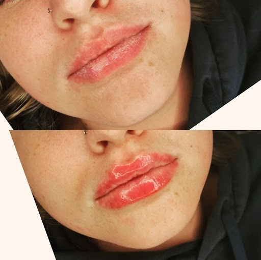 Feel Beautiful Aesthetics - Thumbnail