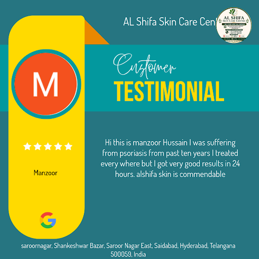 Manzoor's skin woes vanished at AL Shifa Skin Care Centre in Hyderabad! Our expert doctor treated… post image