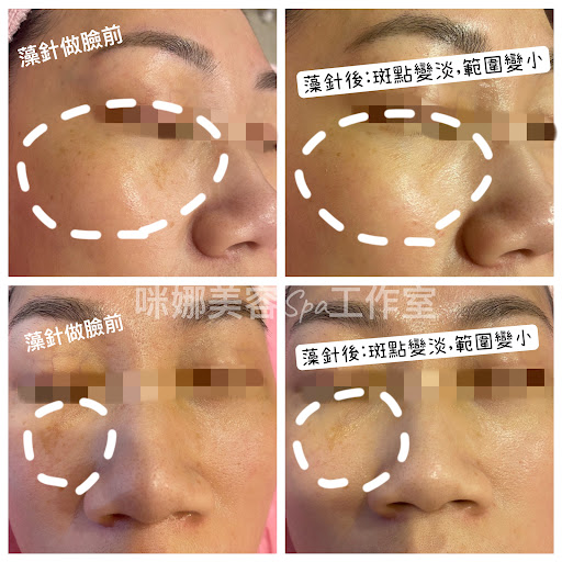 咪娜美容Spa美學評價、價格、網友推薦資訊 - 專業清粉刺與親切服務