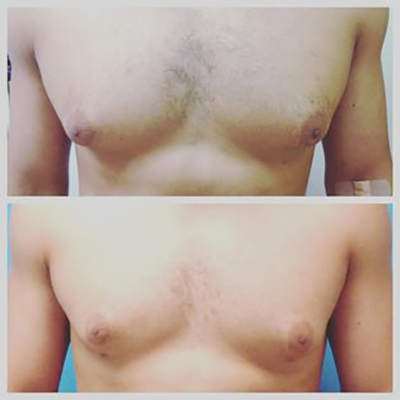 la Piel Perfecta laser center