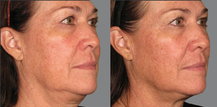 Beverly Hills Rejuvenation Center Westlake Village by null