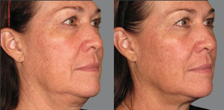 Beverly Hills Rejuvenation Center Westlake Village by null