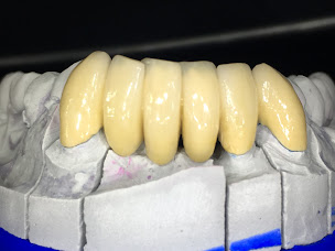 Photo n°6 de Laboratoire Prothèses Dentaires Chauvin à Lacroix-Falgarde (Centre de prothèses dentaires)