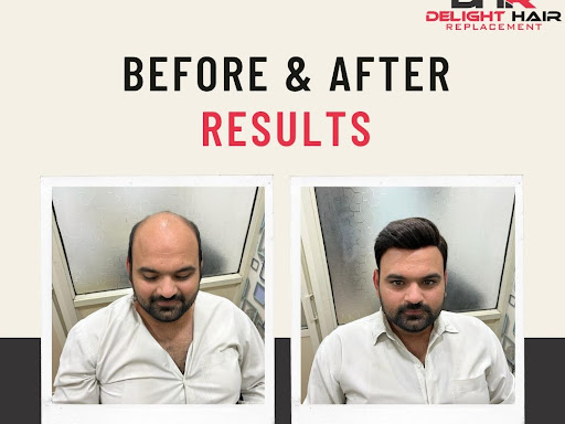 Check Out One Of Our Client Hair Transformation.