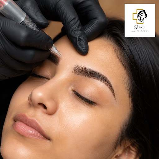 Dreaming of fuller, natural-looking eyebrows without daily makeup? At Renew Aesthetics and Renew… post image