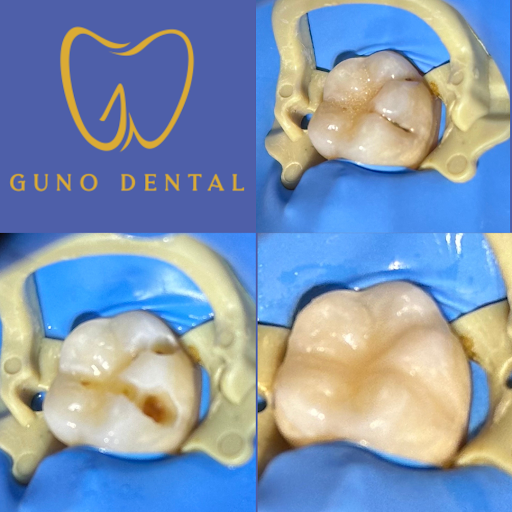 Guno Dental - Thumbnail