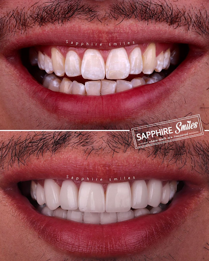 Sapphire Smiles Gallery - United States