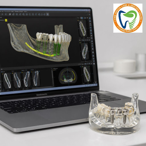 Wondering how to get safe, long-lasting dental implants near you? At Dr Smita Chauhan's CMH Denta…