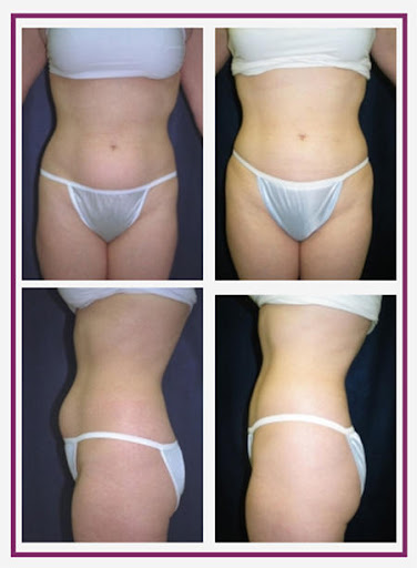 Nashua Plastic Surgery: George P. Chatson, M.D.
