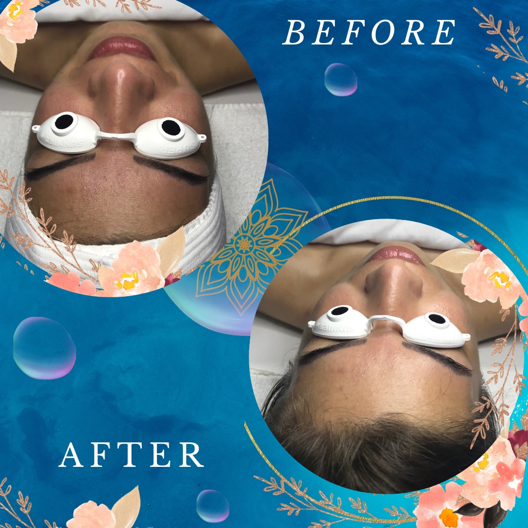 Rejuvenate Tampa Bay Spa : FACIAL ALCHEMIST ! photo 27