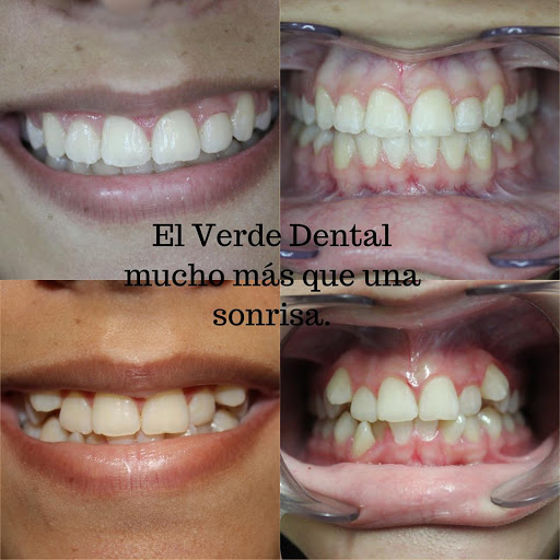 El Verde Dental